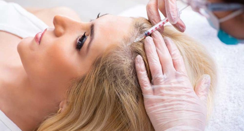 PRP Hair Treatment